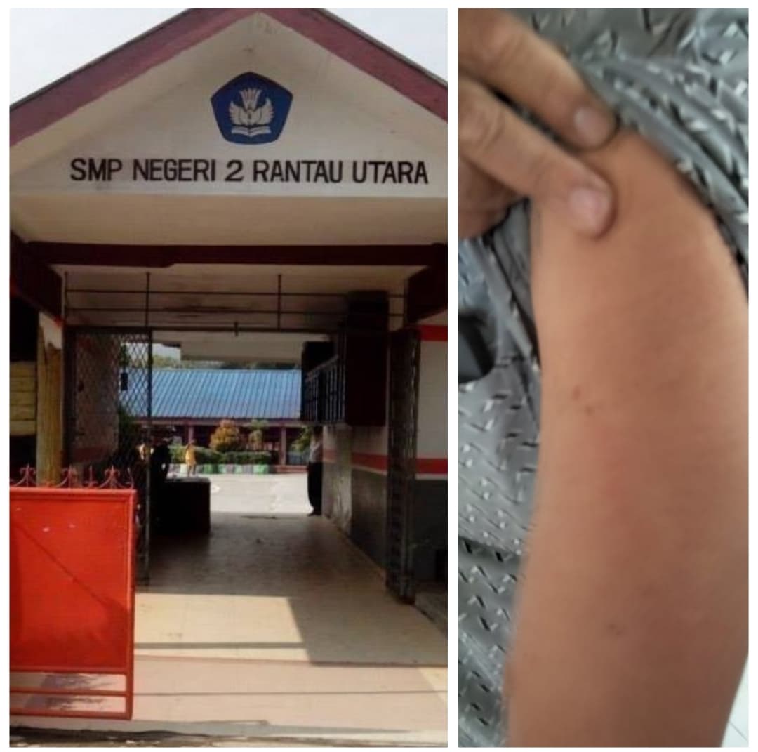 Titip Kaca Mata Anaknya, Oknum Guru SMP Negeri 2 Rantau Utara Diduga Aniaya Orang Tua Siswa Di Jam Belajar